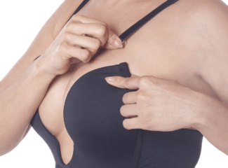 Implante de próteses mamárias:  5 perguntas antes de fazer a cirurgia