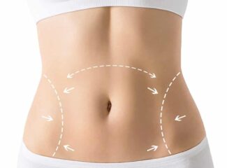 5 dicas essenciais para quem tem interesse em realizar uma abdominoplastia