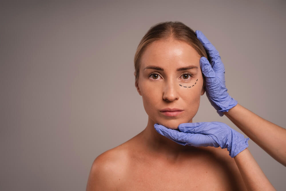 mulher com marcação no rosto se preparando para cirurgia.